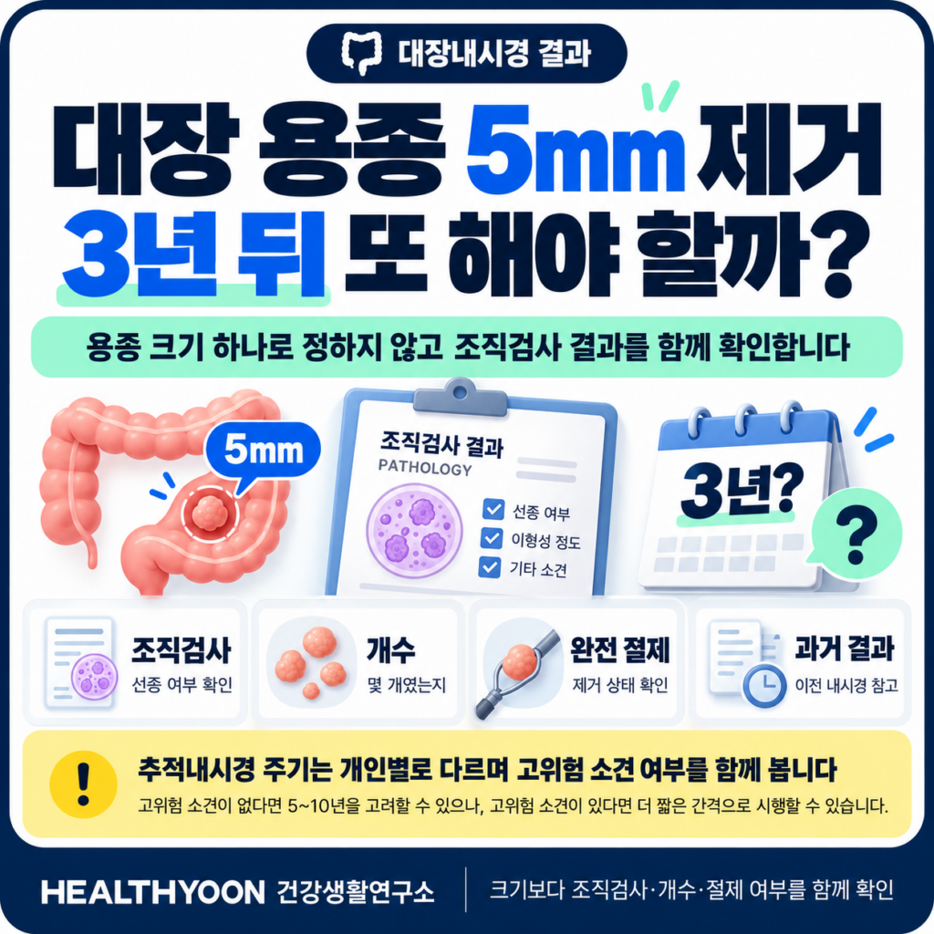 대장 용종 제거 후 추적내시경, 5mm면 3년 뒤 다시 해야 할까?