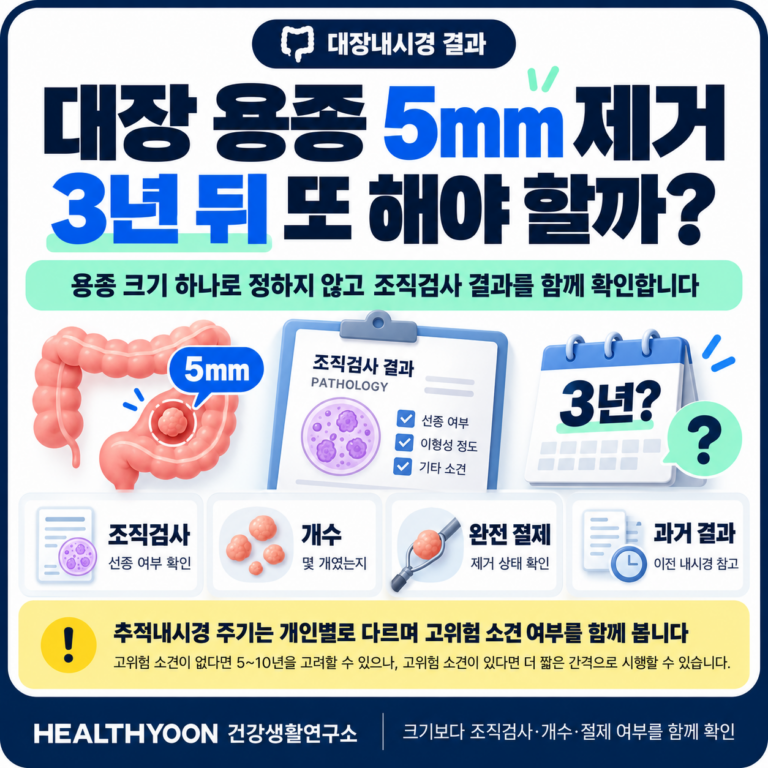 대장 용종 제거 후 추적내시경, 5mm면 3년 뒤 다시 해야 할까?