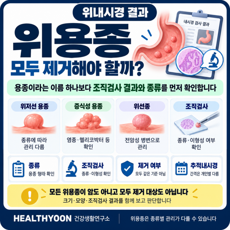 위내시경 위용종 발견, 모두 제거해야 할까? 조직검사 결과부터 보는 이유
