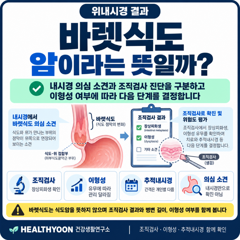 위내시경 바렛식도 소견, 암이라는 뜻일까? 조직검사와 추적내시경 확인