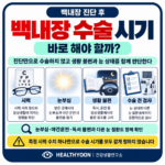 백내장 수술 시기, 진단받으면 바로 해야 할까? 시력과 생활 불편 판단 기준