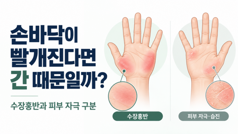 손바닥이 빨개지는 이유, 수장홍반과 피부 자극 구분 기준