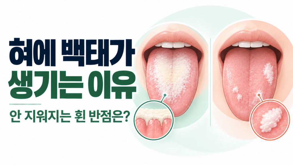 혀에 백태가 생기는 이유, 흰 백태와 흰 반점 구분