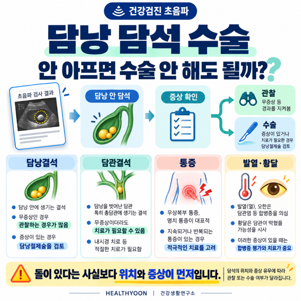담낭 담석 수술, 안 아프면 안 해도 될까? 관찰과 치료를 나누는 기준